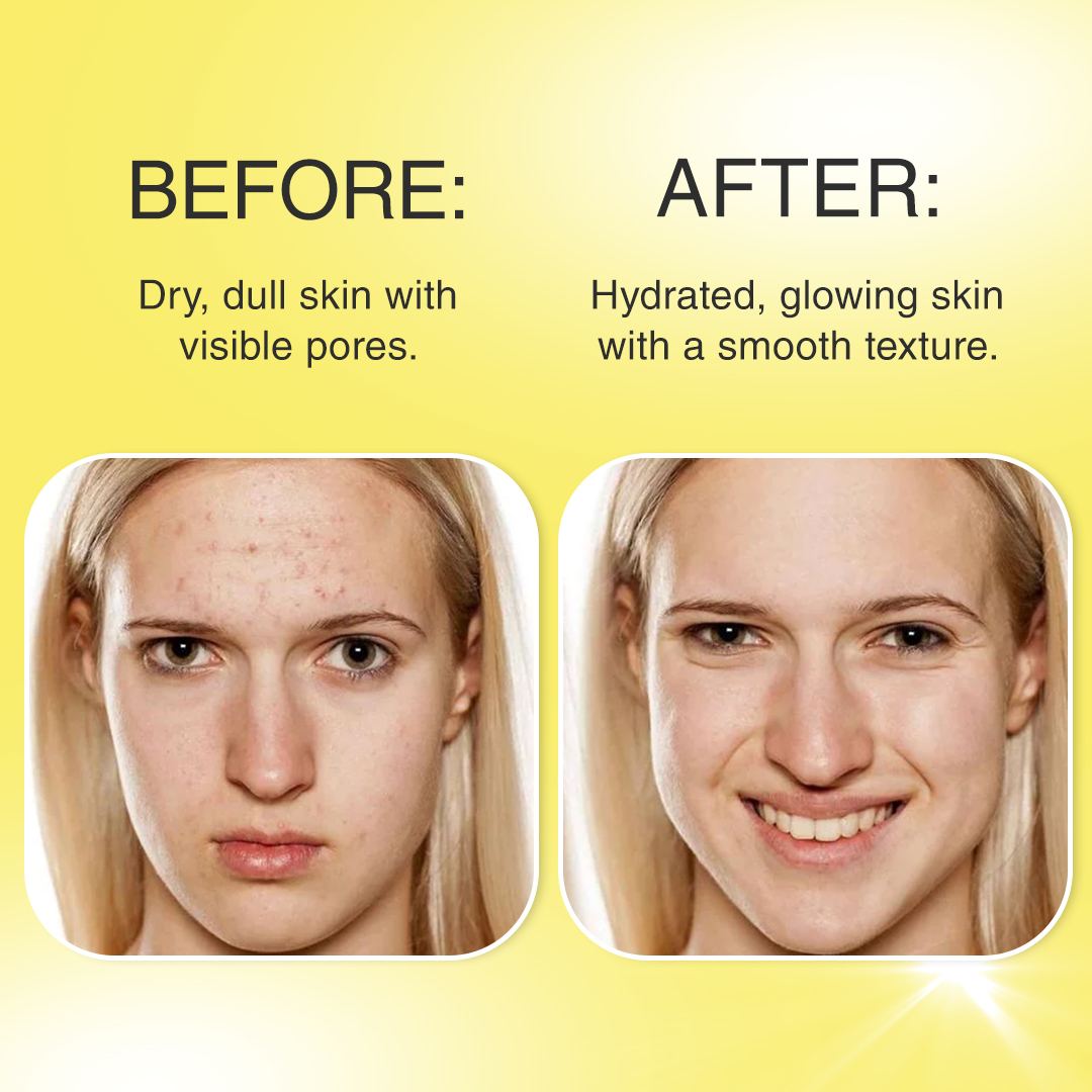 Zorvo™ Collagen Jelly Cream