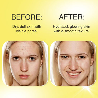 Zorvo™ Collagen Jelly Cream